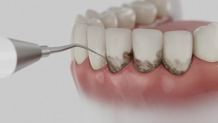 Reliable Dental Implants contractor in Derry, PA by Smile Center Dentistry